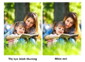 Bệnh mờ mắt là triệu chứng của bệnh gì? 
